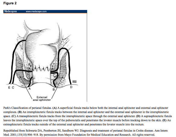 Screenshot from Medscape: http://www.ncbi.nlm.nih.gov/pmc/articles/PMC1681560/