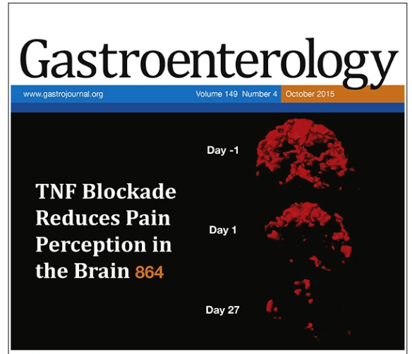 Screen Shot 2015-10-11 at 5.56.36 PM