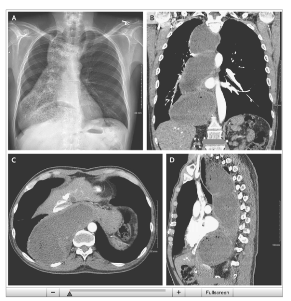 Screen Shot 2016-01-01 at 12.31.40 PM