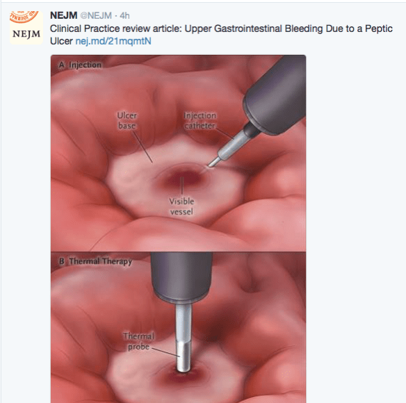 Screen Shot 2016-06-16 at 2.33.58 PM