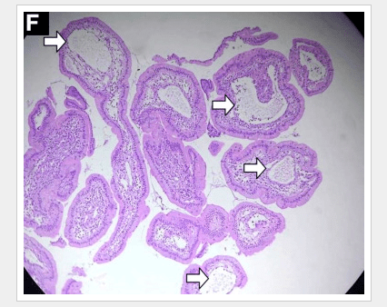 screen-shot-2017-01-10-at-8-04-30-pm