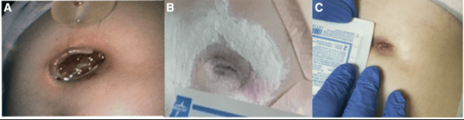 This image has an empty alt attribute; its file name is image-70.png